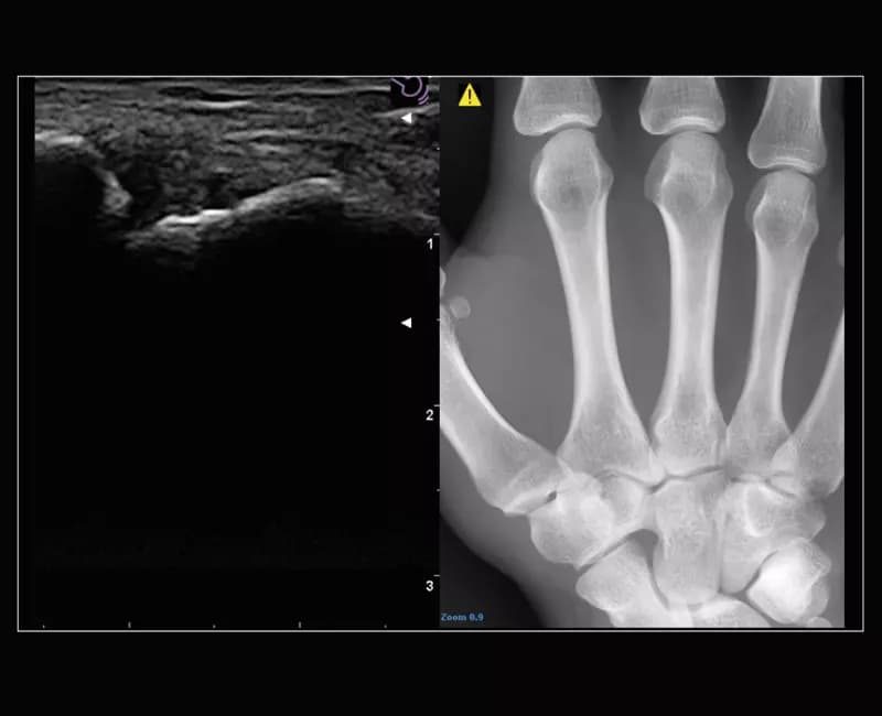 Исследование в области травматологии