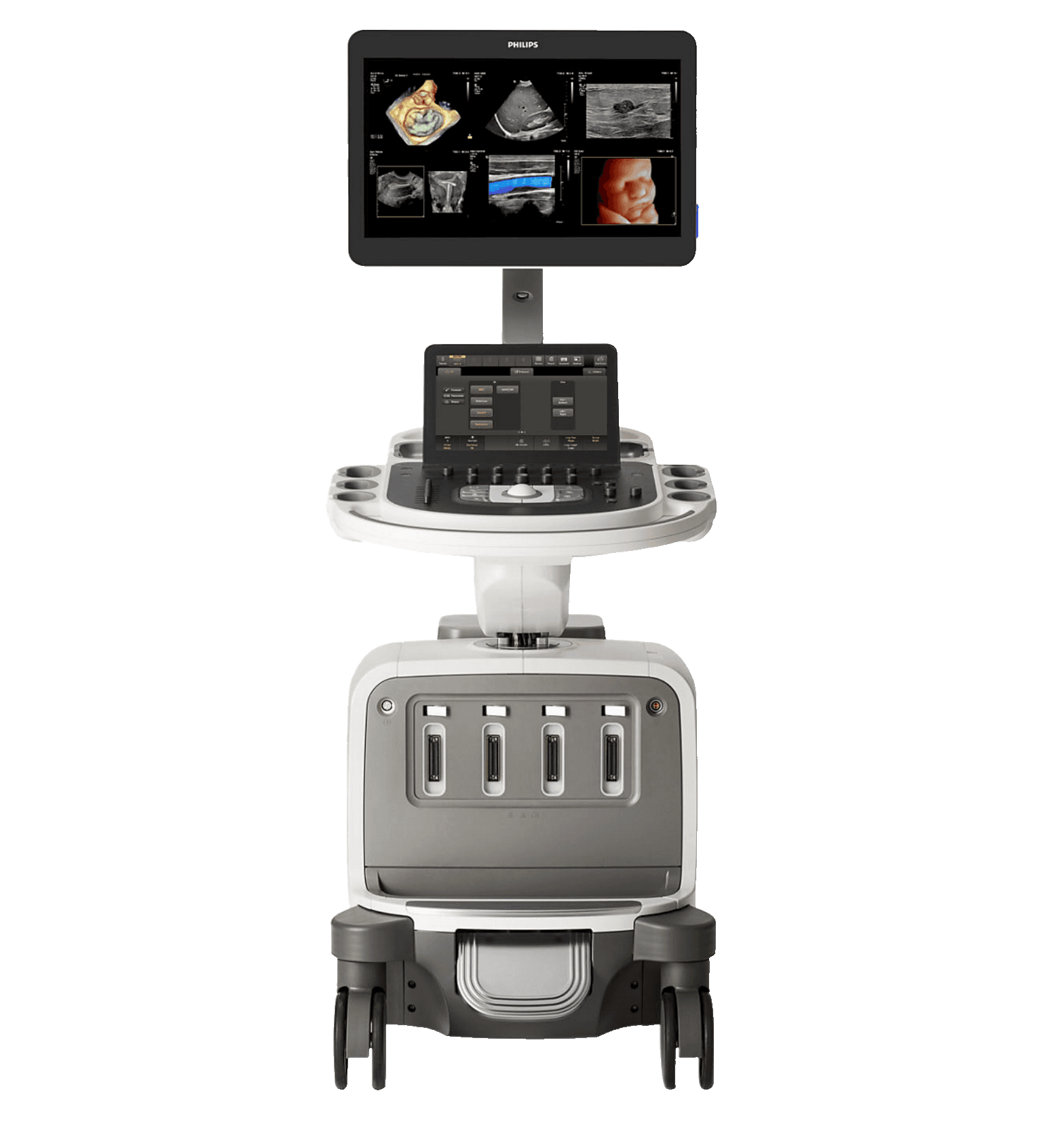 Фото: Philips EPIQ ELITE