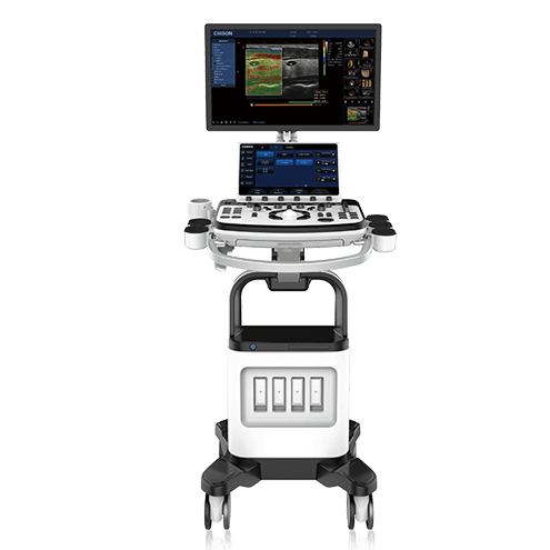 Фото: Chison XBit 80