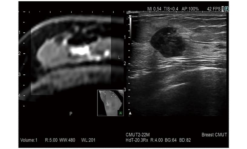 Real-time Virtual Sonography