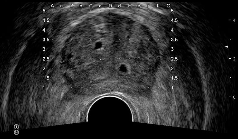 Предстательная железа, поперечный срез