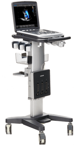 Фото: Chison SonoTouch 80 Expert