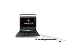 Фото: Chison SonoTouch 60