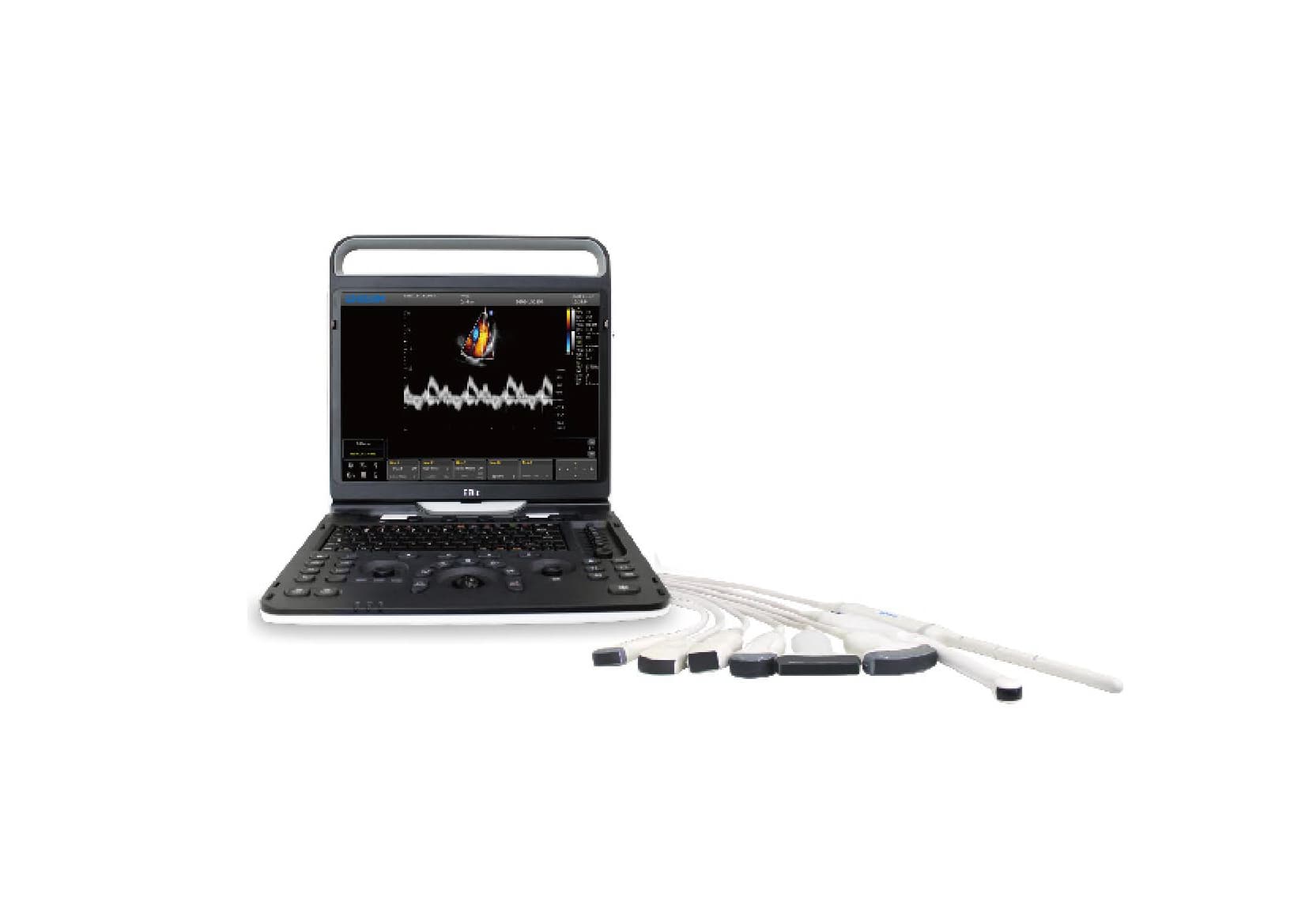 Фото: Chison SonoTouch 60