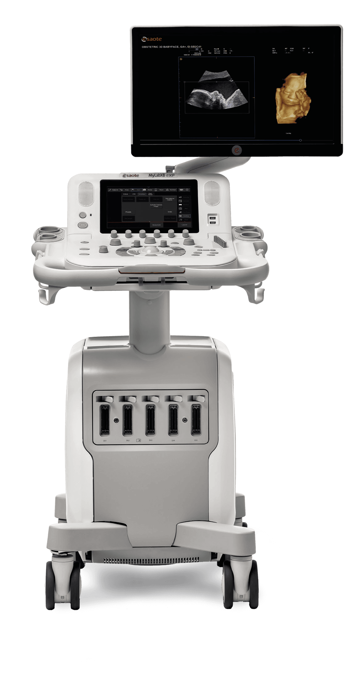 Фото: Esaote MyLab Х8