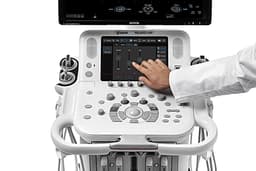 Фото: Esaote MyLab Х8exp