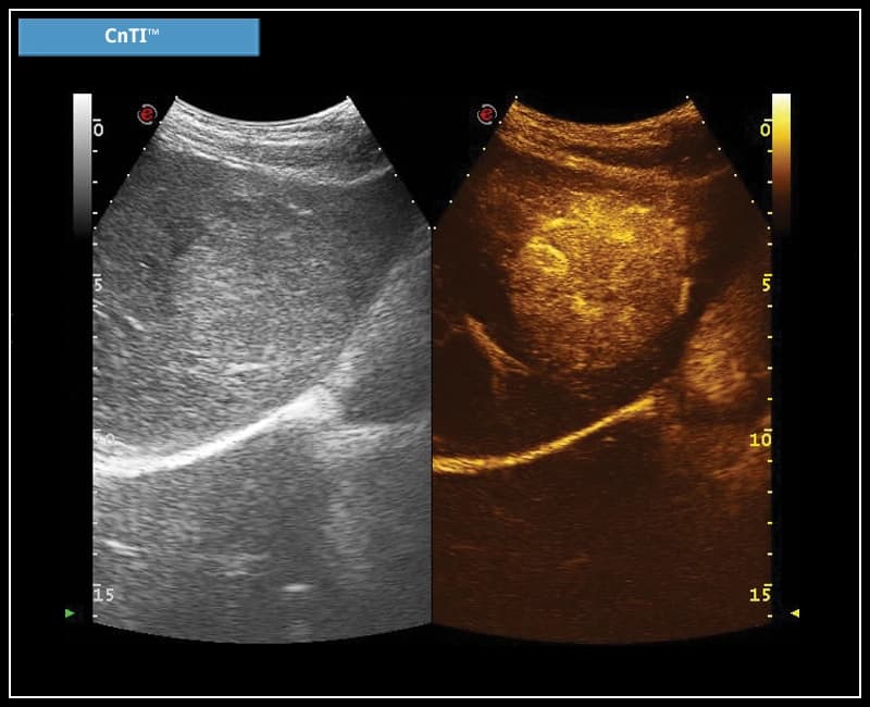 Технология визуализации с усиленным контрастом