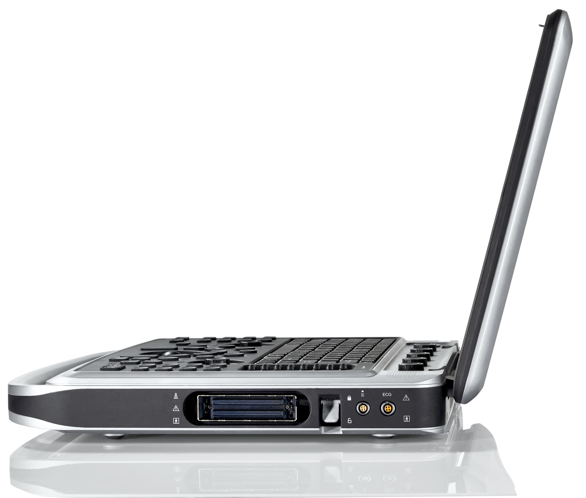 Фото: Chison SonoTouch 80 Expert