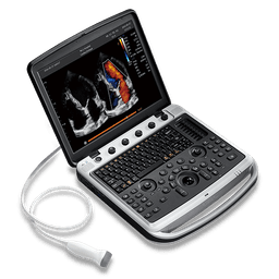 Фото: Chison SonoTouch 80 Expert