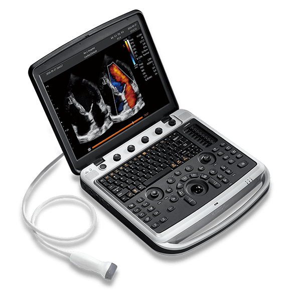 Фото: Chison SonoTouch 80 Expert