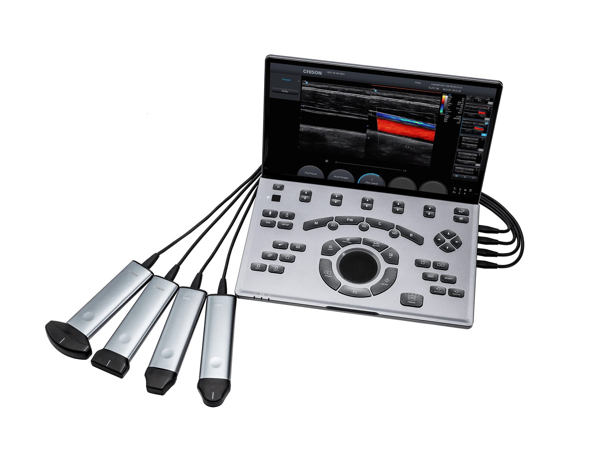 Фото: Chison SonoTouch 50