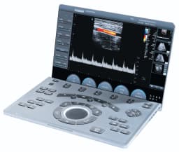 Фото: Chison SonoTouch 50