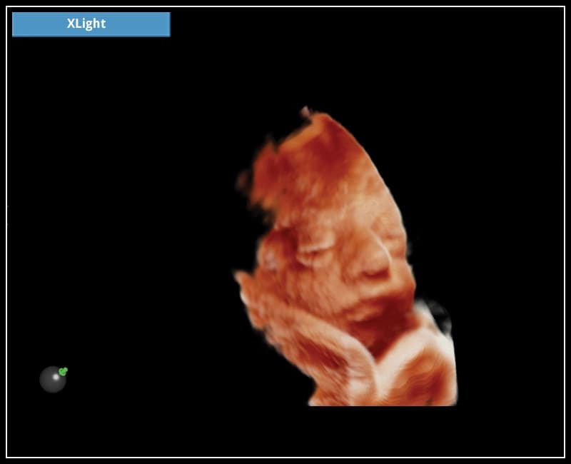 Алгоритм для улучшения качества объемного рендеринга – XLight