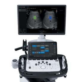 Фото: Samsung V8