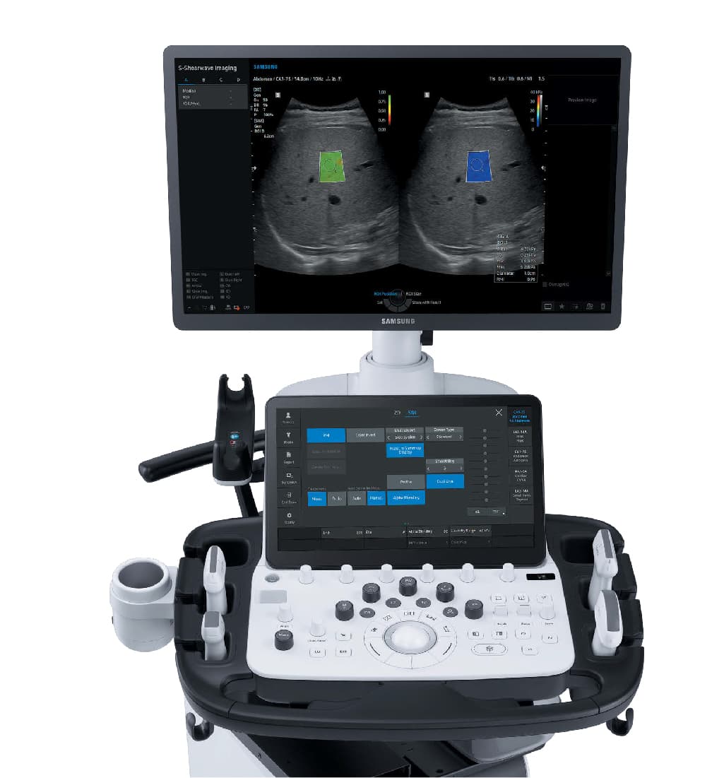 Фото: Samsung V8