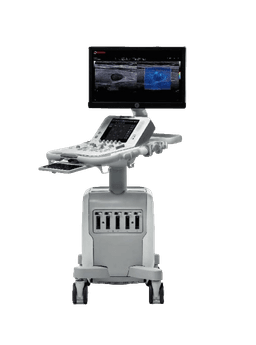 Фото: Esaote MyLab Х8exp