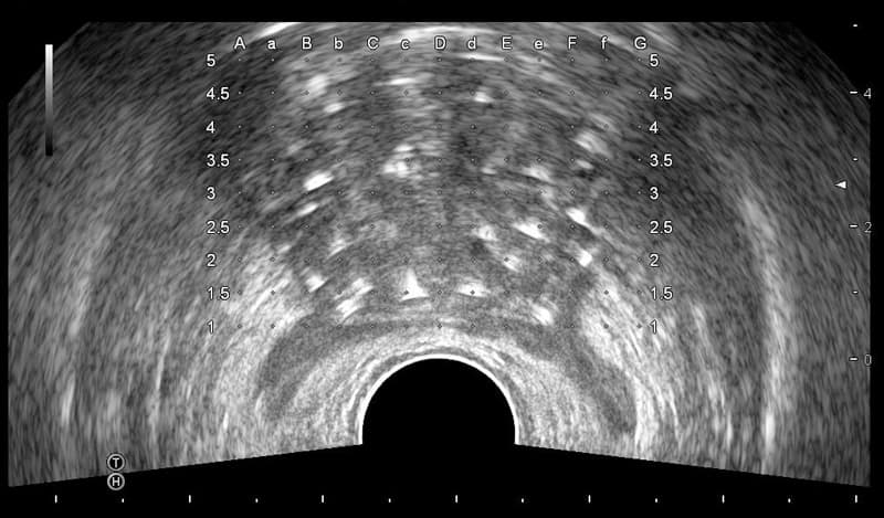 Предстательная железа, поперечный срез