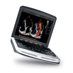 Фото: Chison SonoTouch 80 Expert