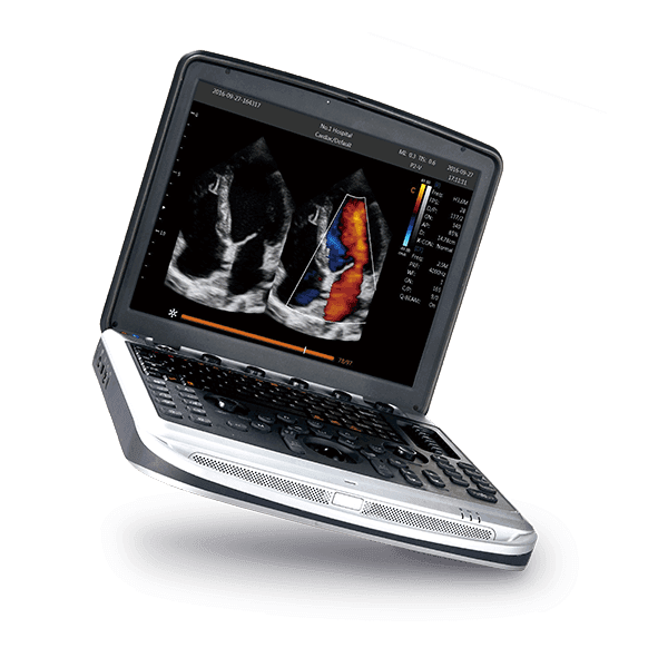 Фото: Chison SonoTouch 80 Expert