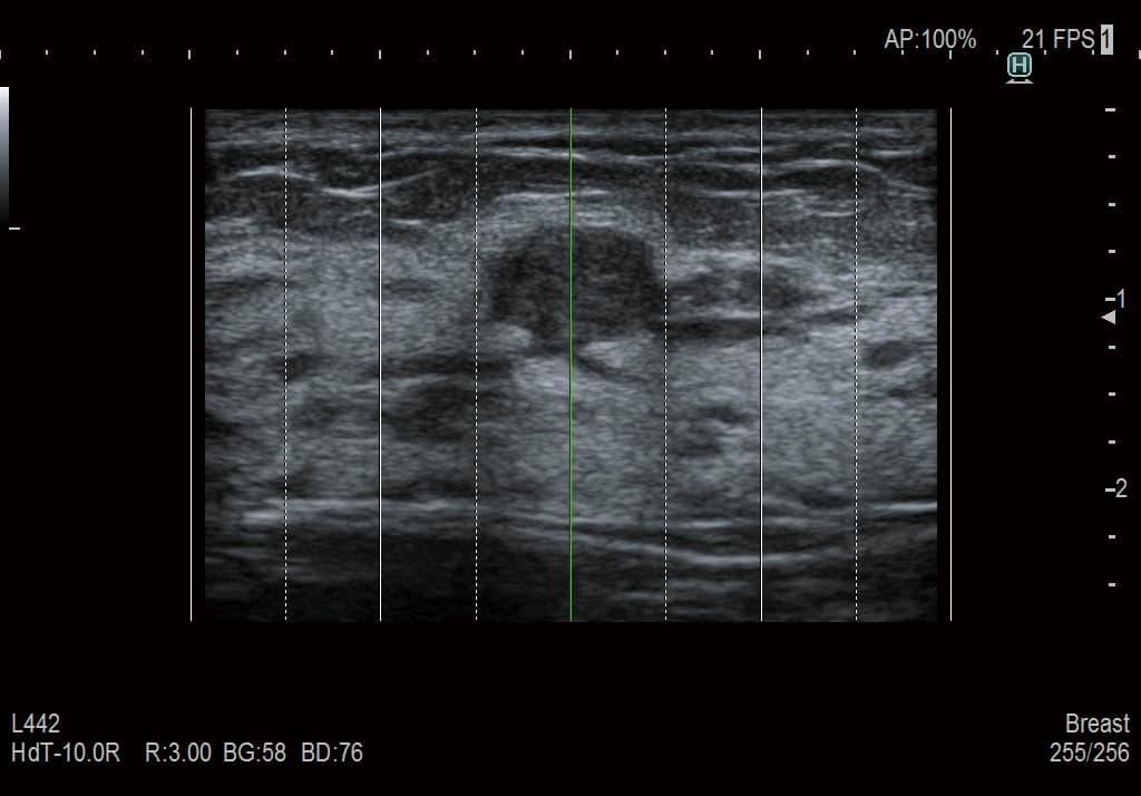Режим Assist Line