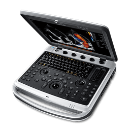 Фото: Chison SonoTouch 80 Expert