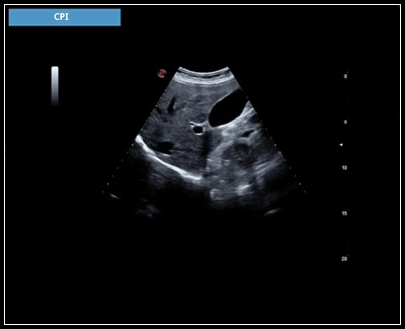 Комбинация низкочастотной и высокочастотной модуляции – CPI