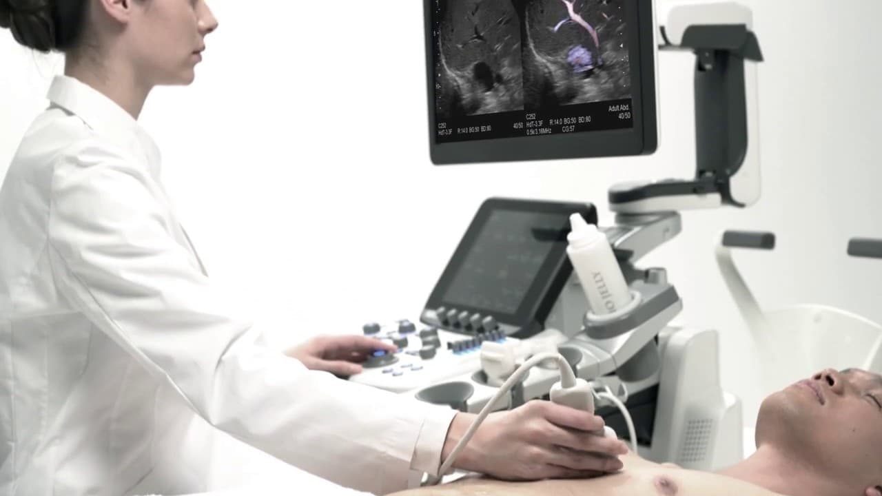 Фото: Fujifilm Arietta 850