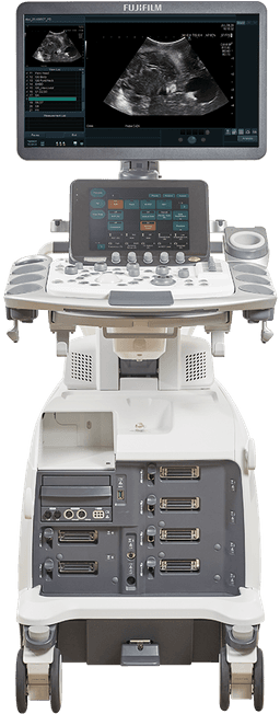 Фото: Fujifilm Arietta 750