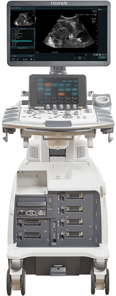 Фото: Fujifilm Arietta 750