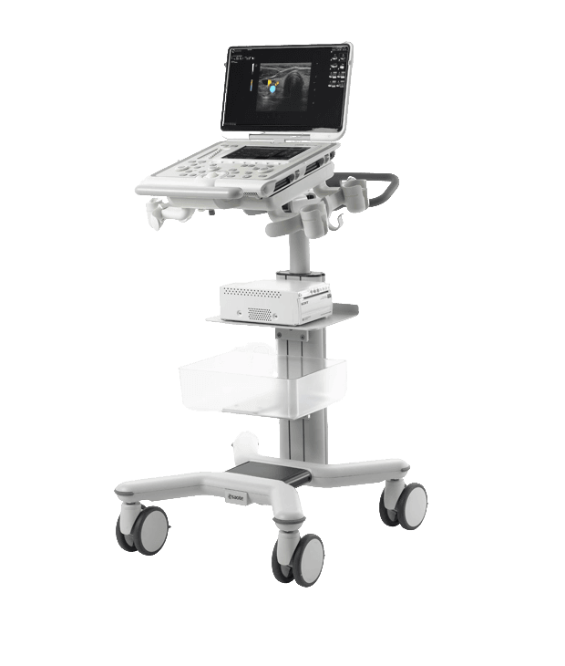 Фото: Esaote MyLab Omega