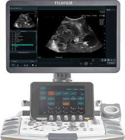 Фото: Fujifilm Arietta 750