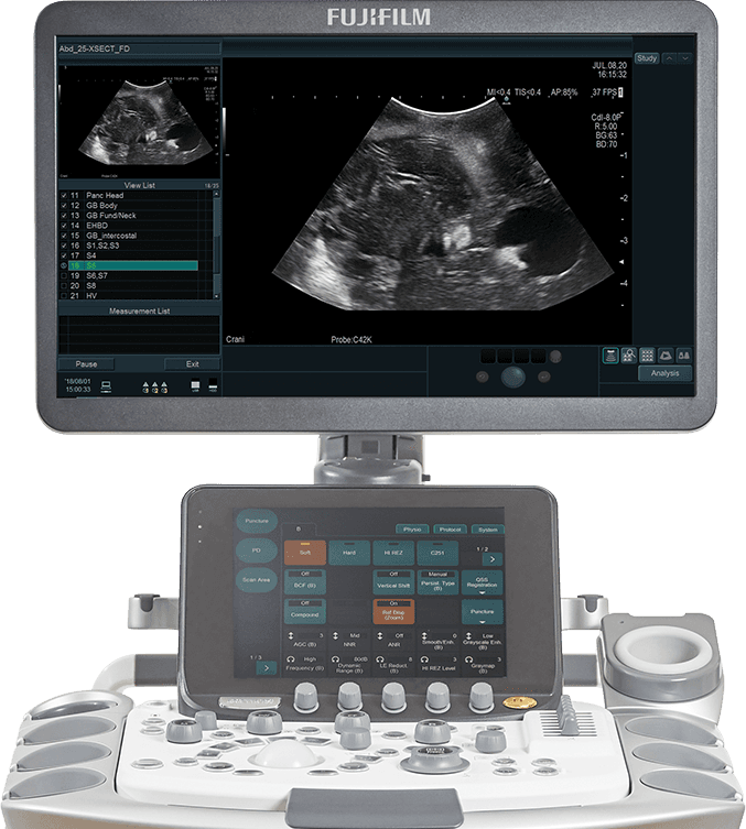 Фото: Fujifilm Arietta 750