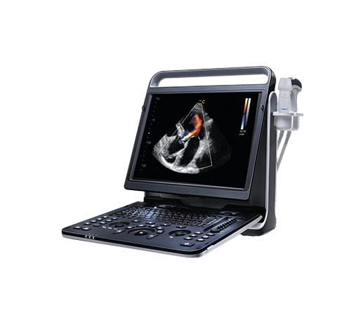 Фото: Chison SonoTouch 60