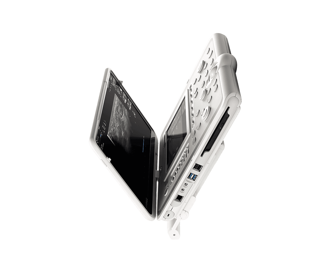 Фото: Esaote MyLab Omega