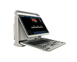 Фото: Chison SonoTouch 60