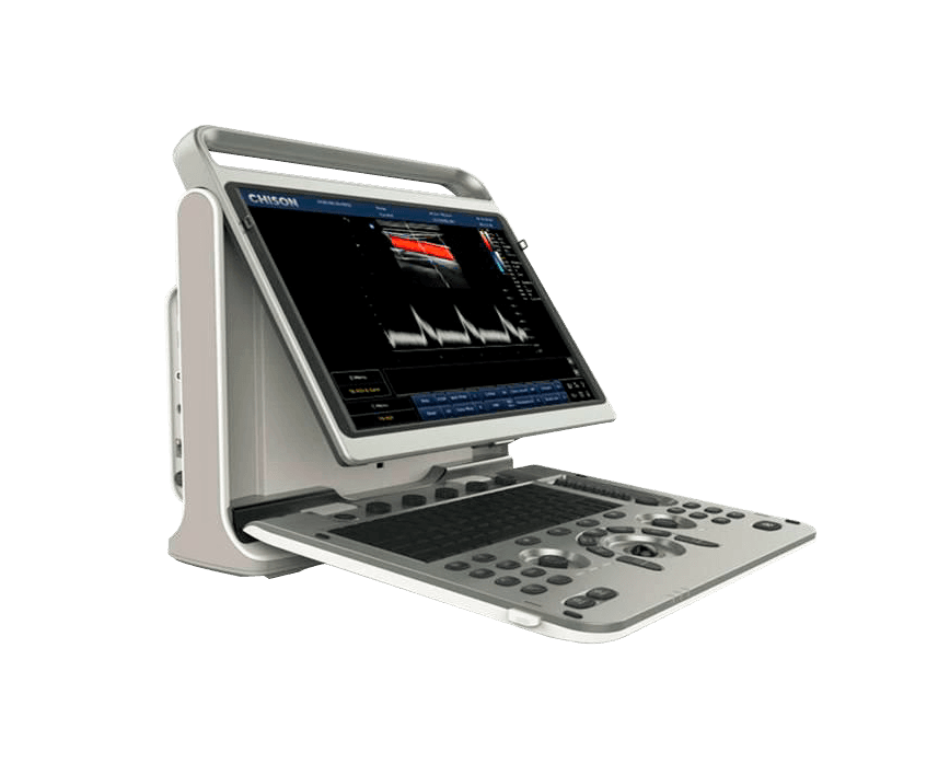 Фото: Chison SonoTouch 60