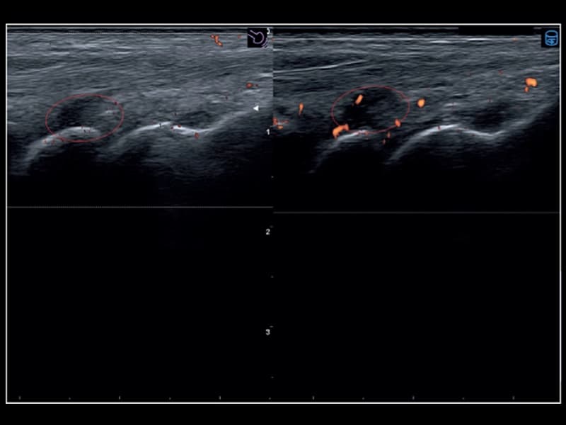 Скелетно-мышечная система - Follow Up и Q-Pack