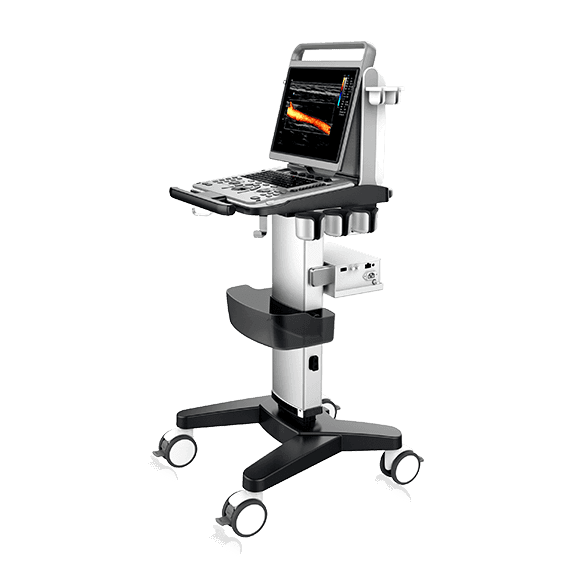 Фото: Chison SonoTouch 60