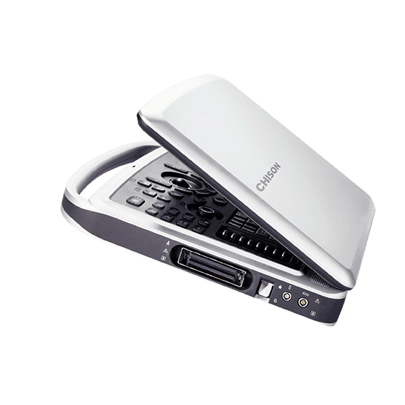 Фото: Chison SonoTouch 80 Expert