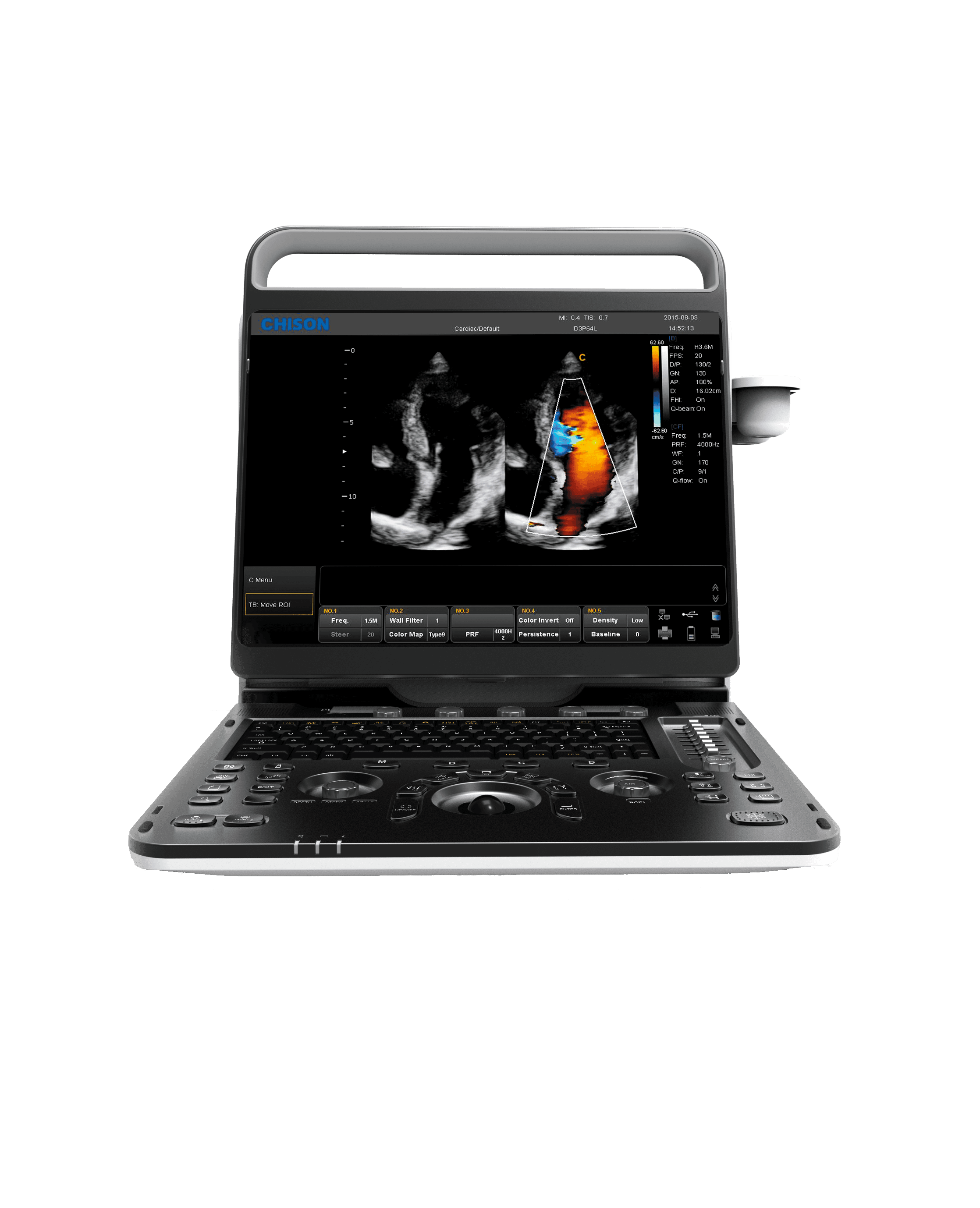 Фото: Chison SonoTouch 60