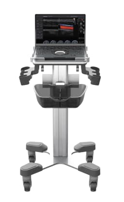 Фото: Chison SonoTouch 50