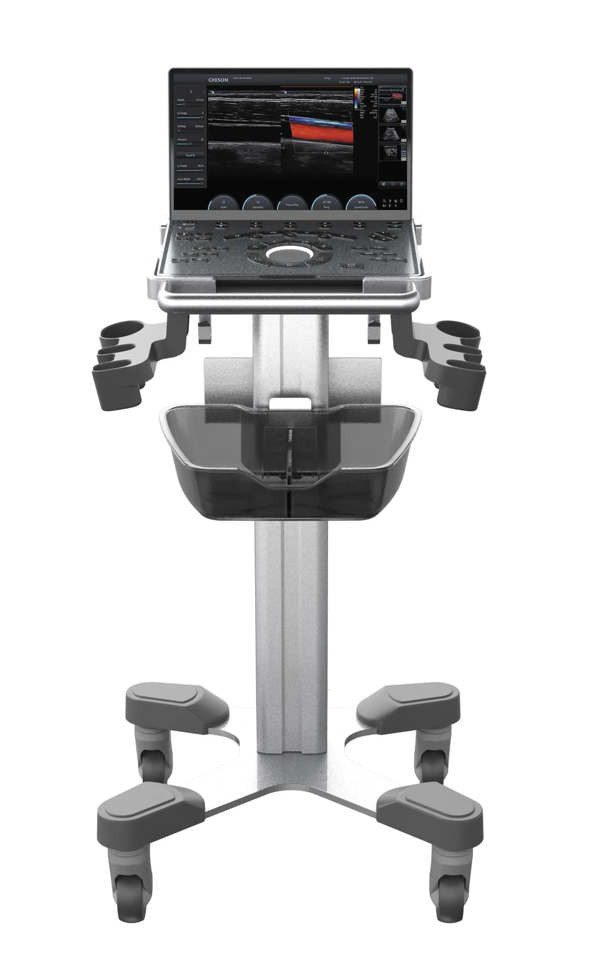 Фото: Chison SonoTouch 50